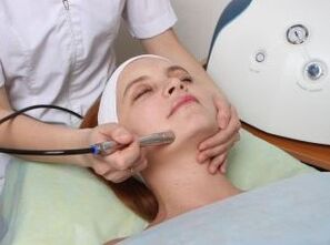 Laser rejuvenation of the face