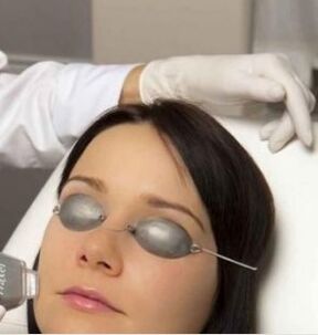 Field laser rejuvenation