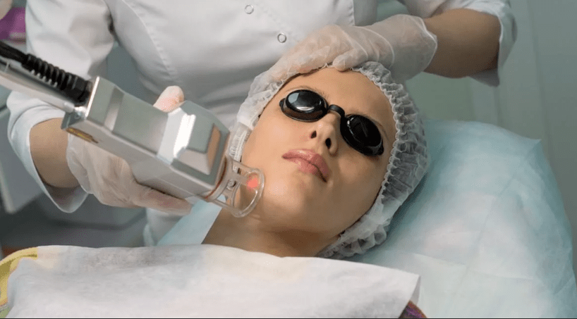 Ablye fotothermolysis