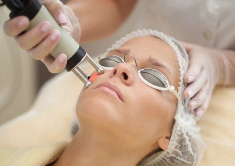 Field laser rejuvenating procedure