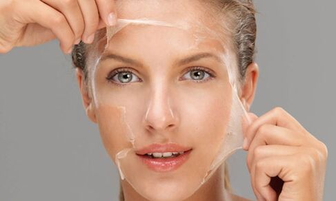 Deep peeling strengthens regeneration processes in the skin, rejuvenates it